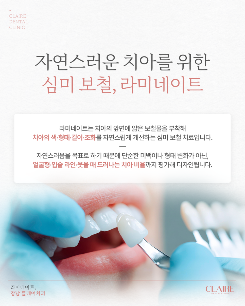 Gangnam Laminate Dental Clinic: Laminate for Natural Aesthetic Restorations image 2
