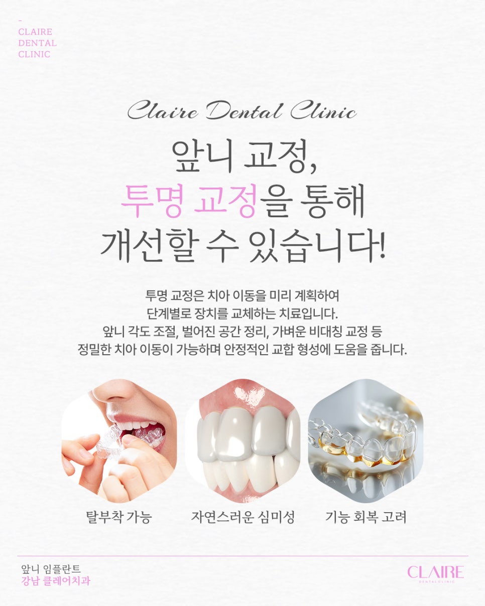 대치동투명교정 앞니 교정, 정밀함이 결과를 좌우합니다 관련 이미지 9