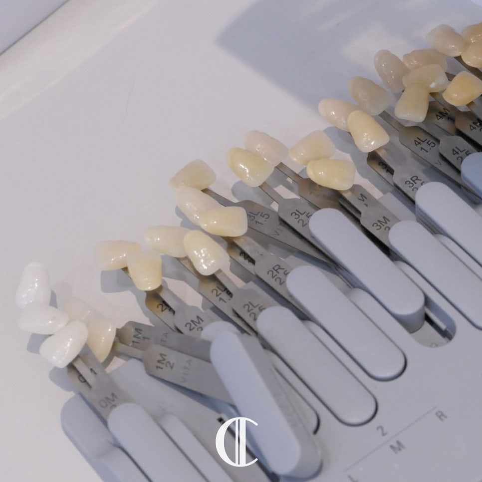 Lami Dental Clinic Gangnam: How to Whiten Yellow Teeth with Small Teeth and Yellow Dentin? image 2