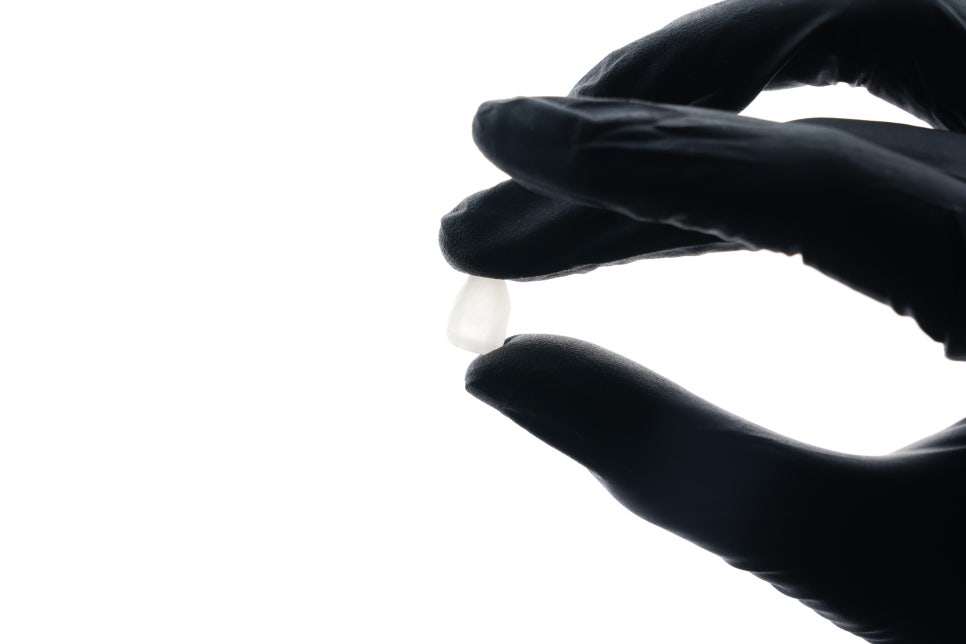 강남라미네이트 차이 | 강남 심미치과 선택 기준 관련 이미지 1