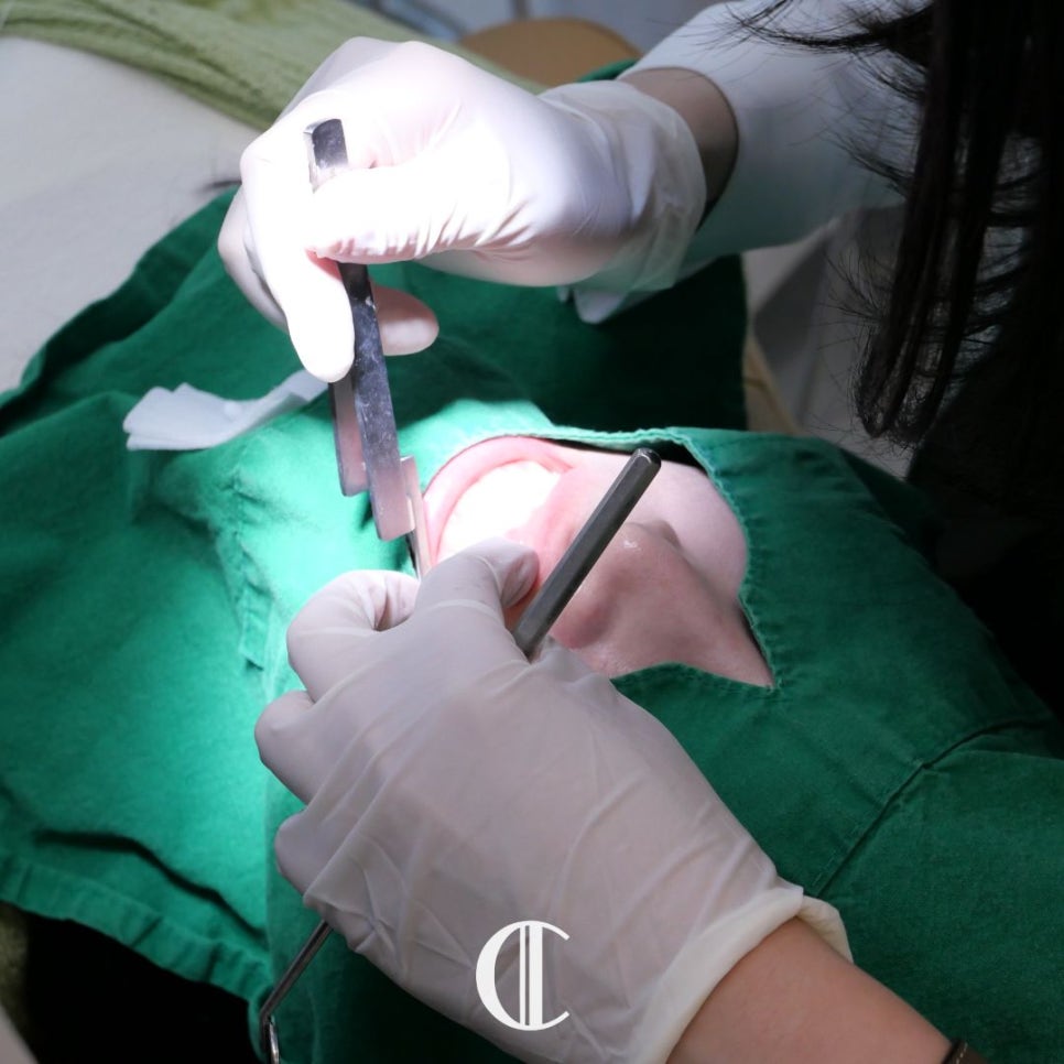 Lami Dental Clinic Gangnam: How to Whiten Yellow Teeth with Small Teeth and Yellow Dentin? image 3