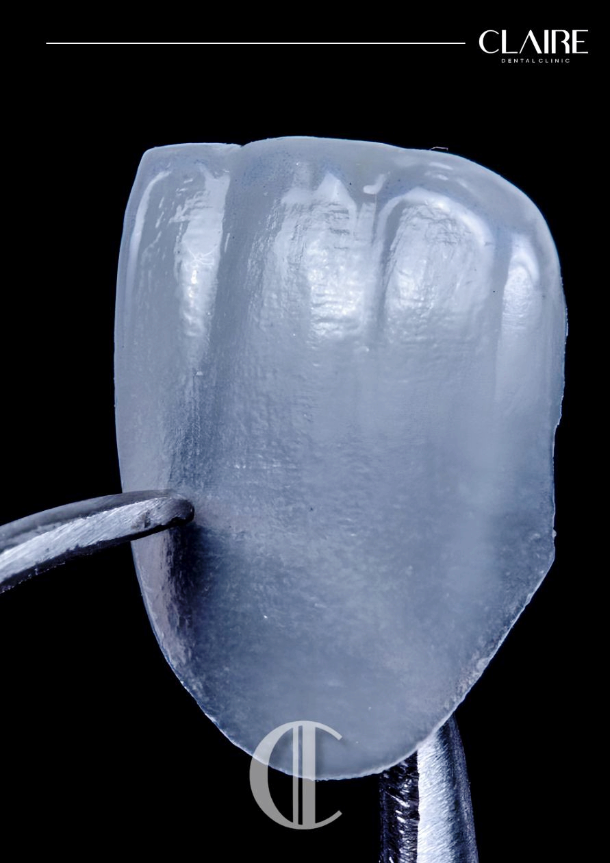 Why Do Coffee and Yellow Teeth Cause Tooth Discoloration at a Hannam-dong Dental Clinic? image 11