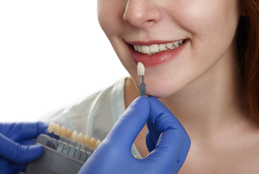 A Lamineer Story the Dentist Will Never Tell You First image 1