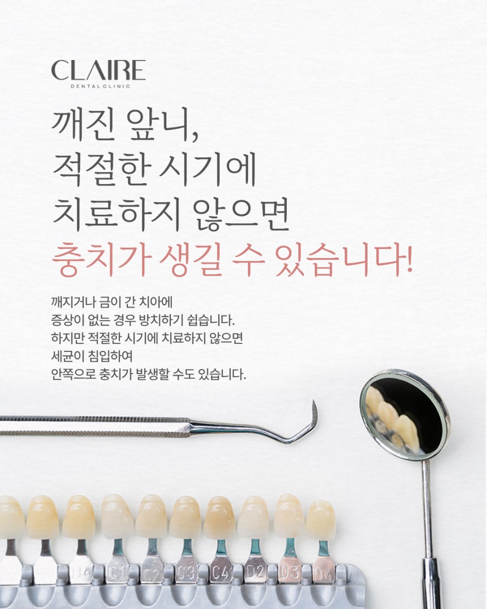 선릉역앞니깨짐 티 안 나게 치료할 수 있을까? 관련 이미지 3