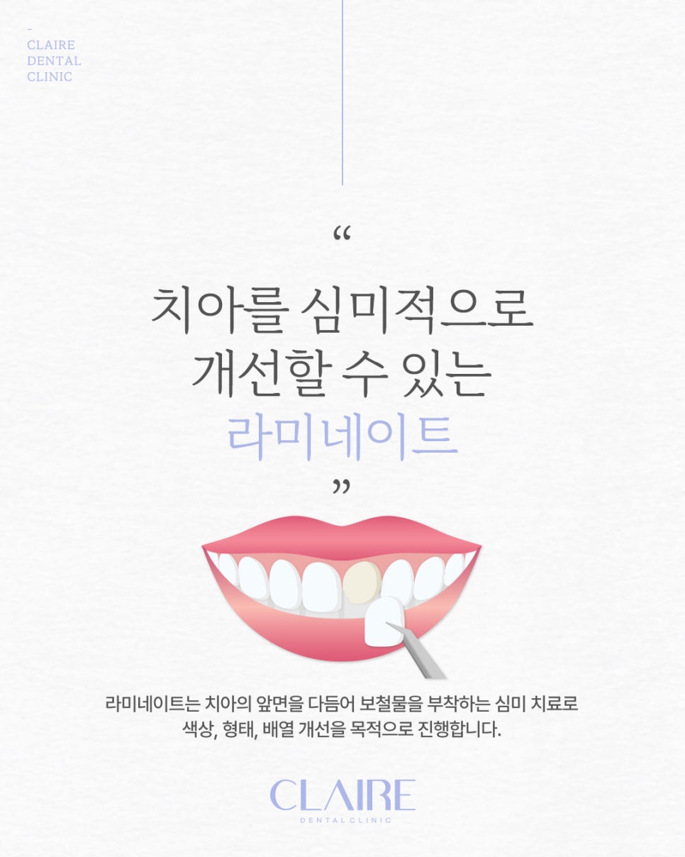 삼성동라미네이트 자연스러움을 위해 관련 이미지 7