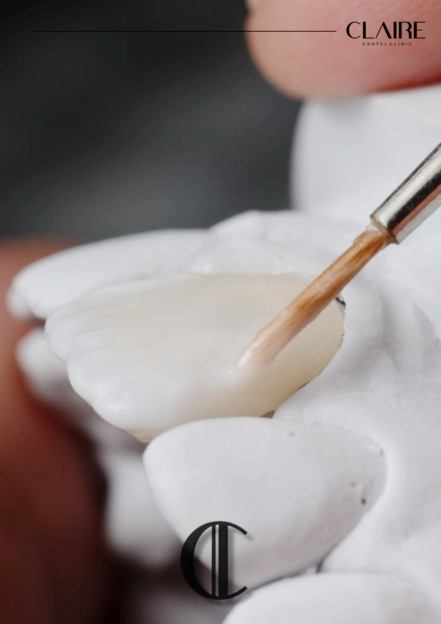 Why Do Coffee and Yellow Teeth Cause Tooth Discoloration at a Hannam-dong Dental Clinic? image 7