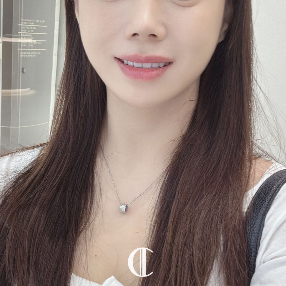 Lami Dental Clinic Gangnam: How to Whiten Yellow Teeth with Small Teeth and Yellow Dentin? image 4
