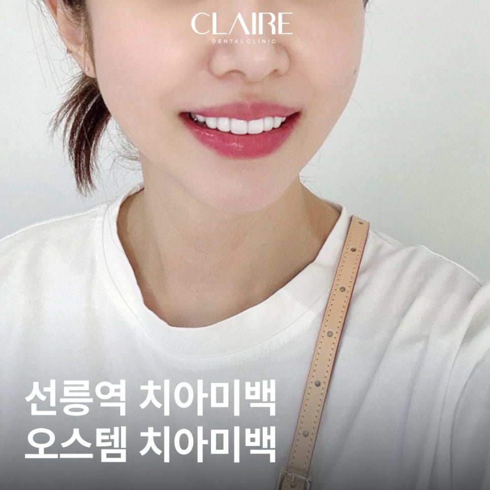 선릉역 치아미백 오스템 뷰티스 15로 커피 치아 착색 bye 관련 이미지 1