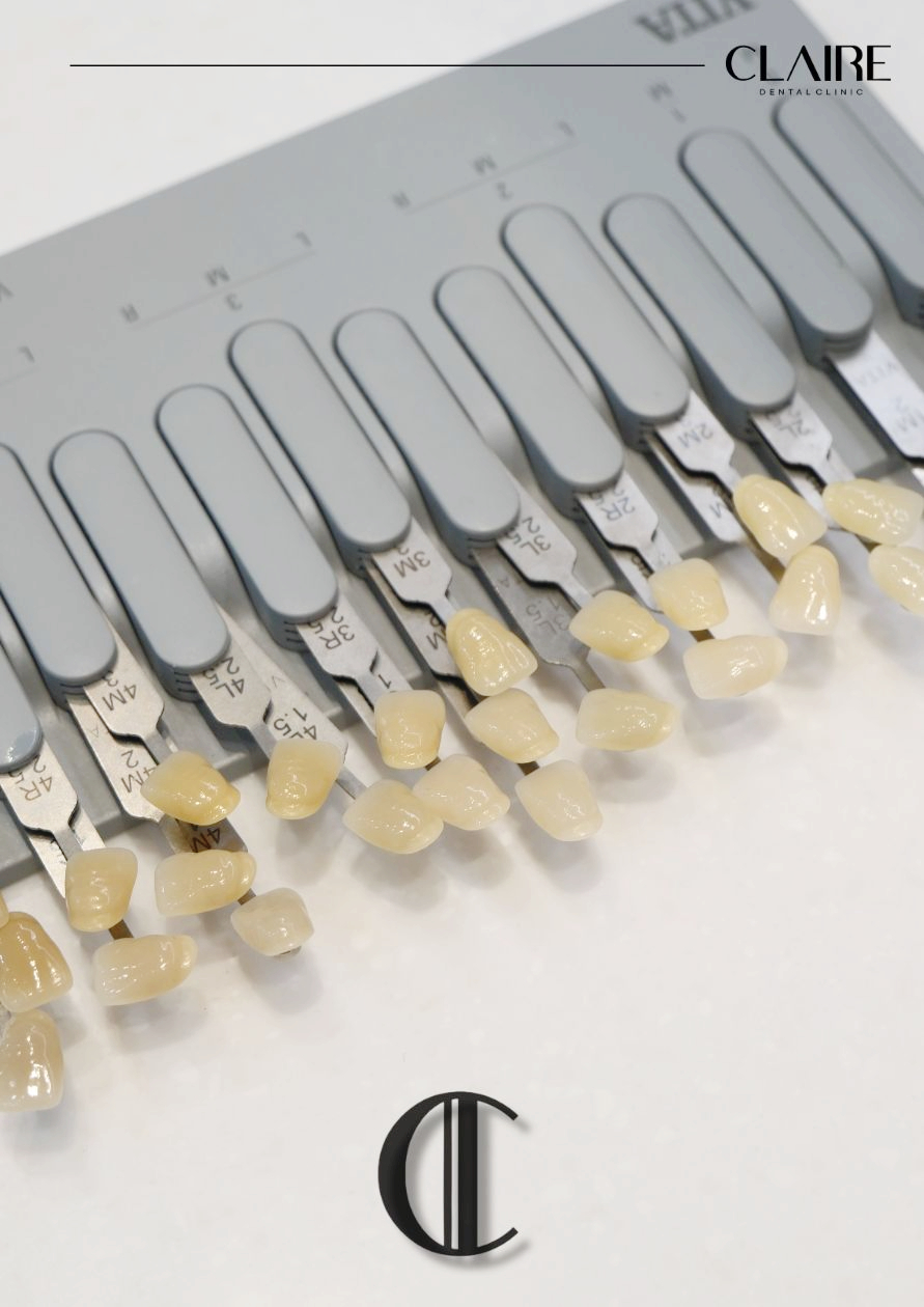 Why Do Coffee and Yellow Teeth Cause Tooth Discoloration at a Hannam-dong Dental Clinic? image 6