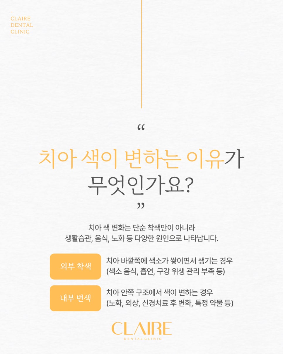 역삼동치과 치아 미백 시작 전 확인해야 할 기준은? 관련 이미지 7