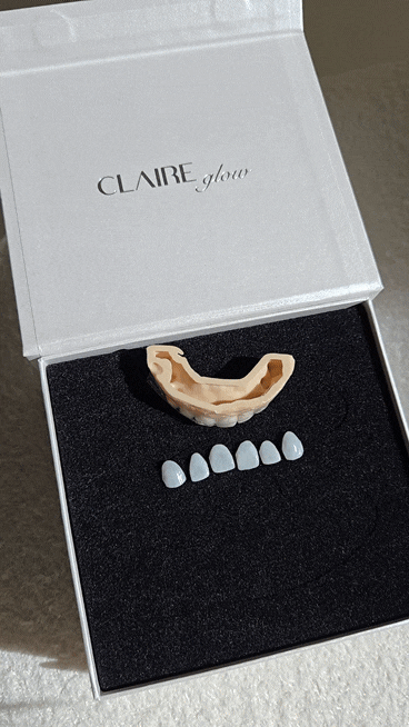 Why Do Coffee and Yellow Teeth Cause Tooth Discoloration at a Hannam-dong Dental Clinic? image 13