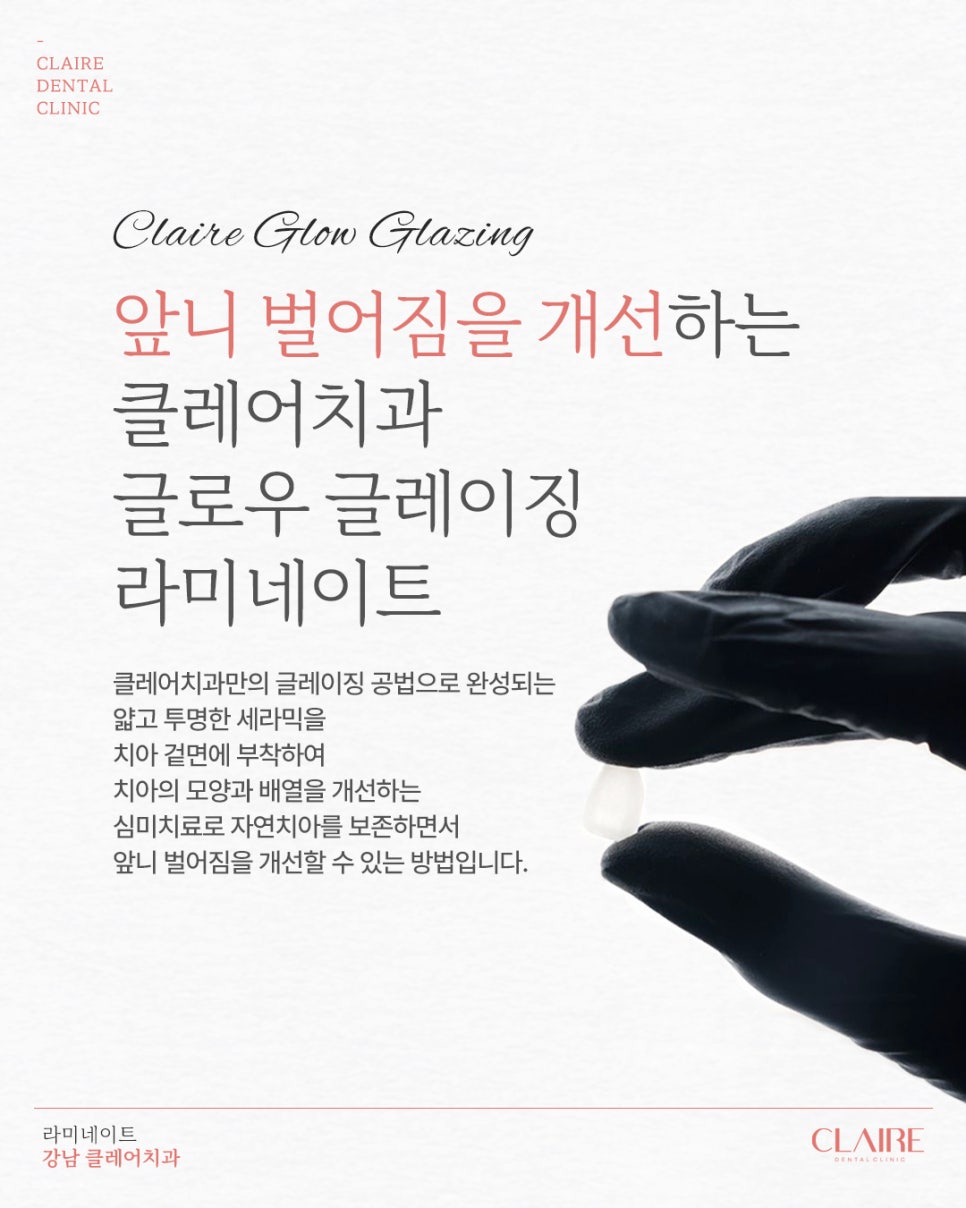 역삼동앞니벌어짐 라미네이트로 자연스럽게! 관련 이미지 4