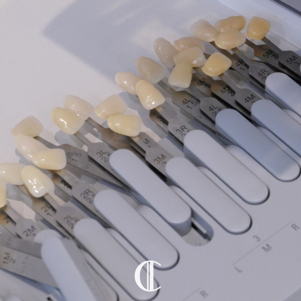 When One-Day Veneers Are Needed and Why Teeth Turn Yellow | Dogok-dong Dental Clinic image 9