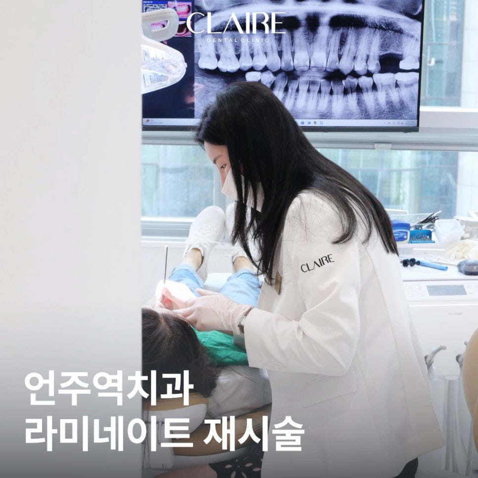 Eonju Station Dental Clinic: For Laminate Veneer Retreatment, Do the Teeth Have to Be Filed Down Again? image 1
