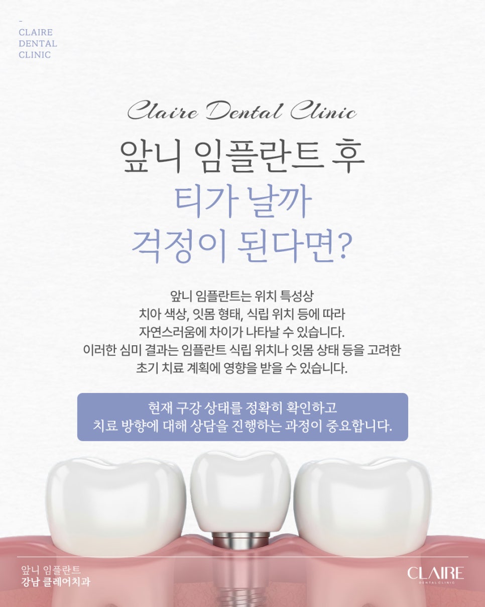 삼성동임플란트 앞니 임플란트 자연스러움이 중요해요 관련 이미지 9