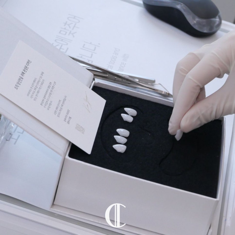 When One-Day Veneers Are Needed and Why Teeth Turn Yellow | Dogok-dong Dental Clinic image 8