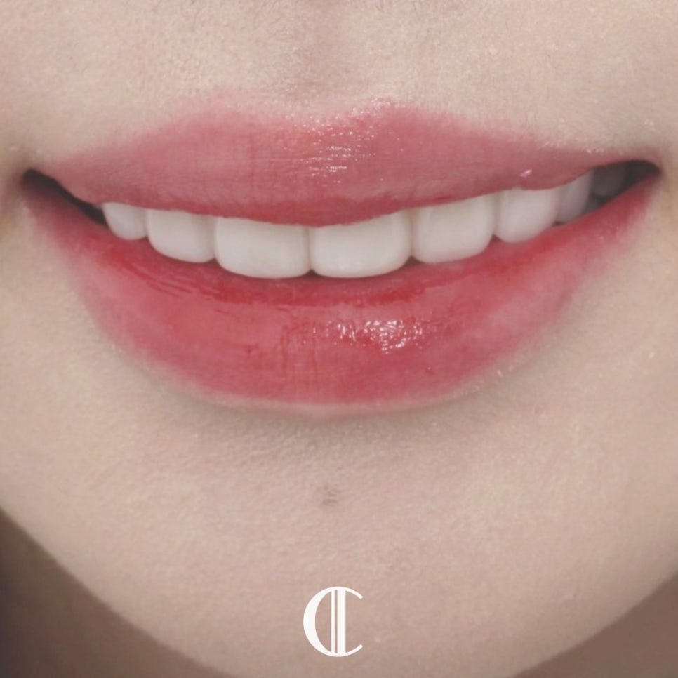 깨진 치아 이가 깨졌을때 예쁘게 복원 가능할까? 관련 이미지 12