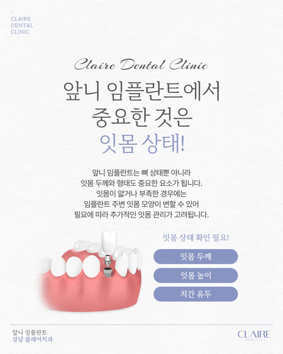 삼성동임플란트 앞니 임플란트 자연스러움이 중요해요 관련 이미지 8