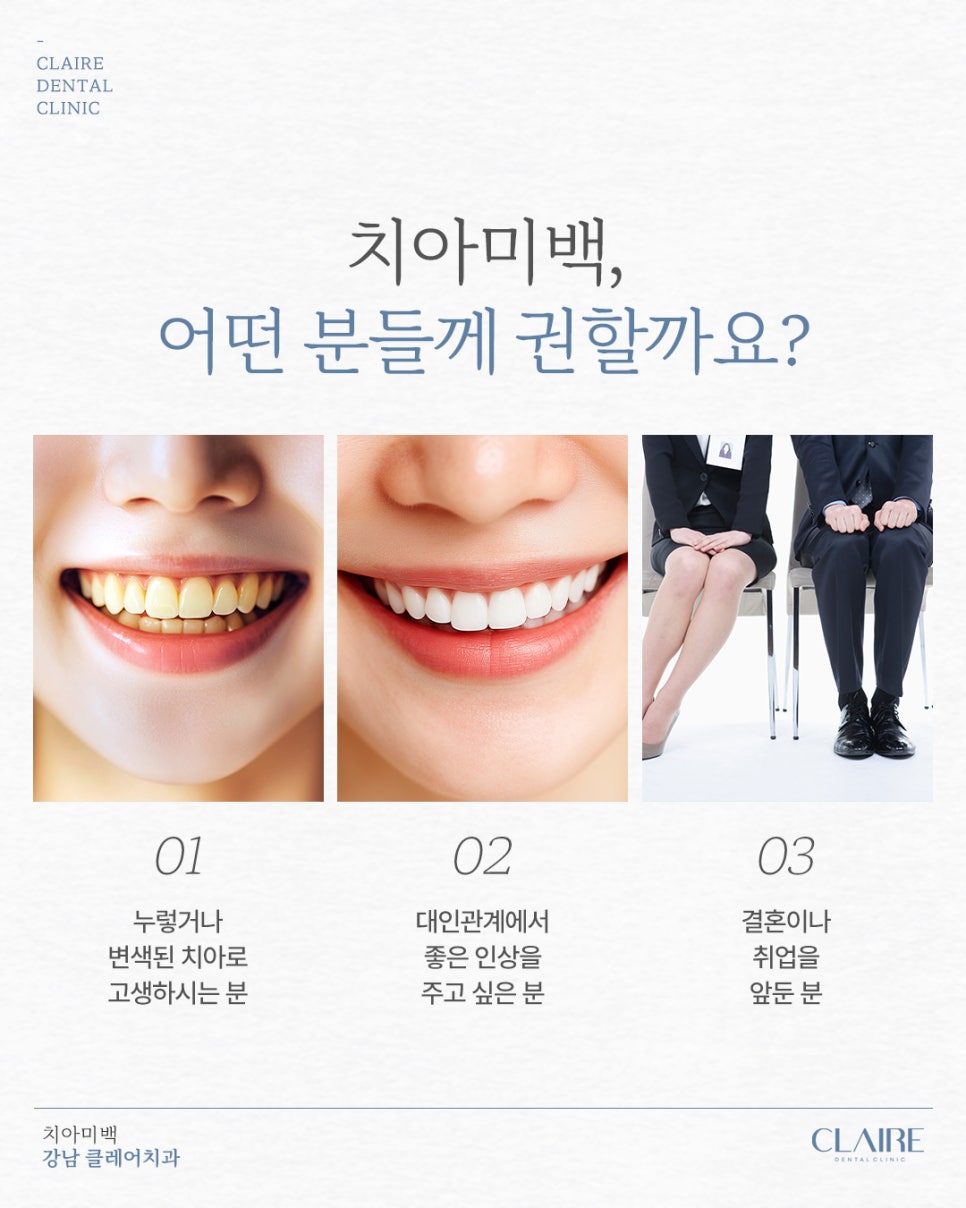 선릉역치아미백 밝은 미소의 시작! 관련 이미지 3