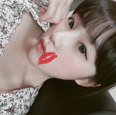 Customized Surgery by Nose Surgery Type, Fast Recovery, and a Good Place for Revision Rhinoplasty: Apgujeong Seoul Plastic Surgery image 7