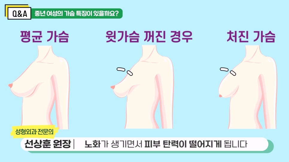 [압구정 중년 가슴수술] 중년 가슴수술에 대한 모든 것! 선상훈 원장님 Q&A 관련 이미지 3