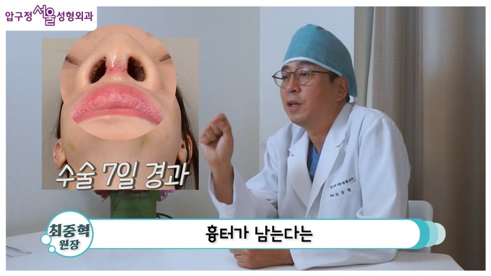 개방형 비개방형 코수술 차이점 장단점까지 한눈에 정리 관련 이미지 14