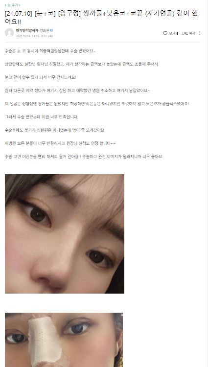 Lovely Eyes Are No Longer Difficult! [Apgujeong Seoul Plastic Surgery] image 5
