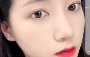 Customized Surgery by Nose Surgery Type, Fast Recovery, and a Good Place for Revision Rhinoplasty: Apgujeong Seoul Plastic Surgery image 2