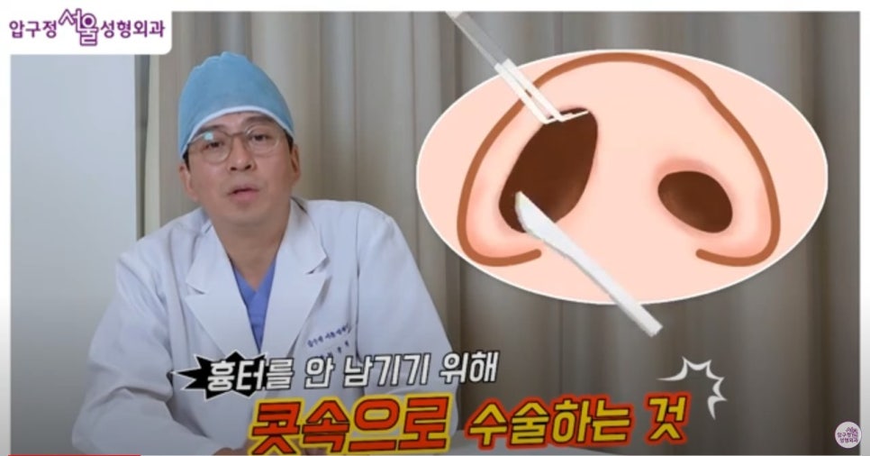 Apgujeong closed rhinoplasty: is it the right method for me? image 2
