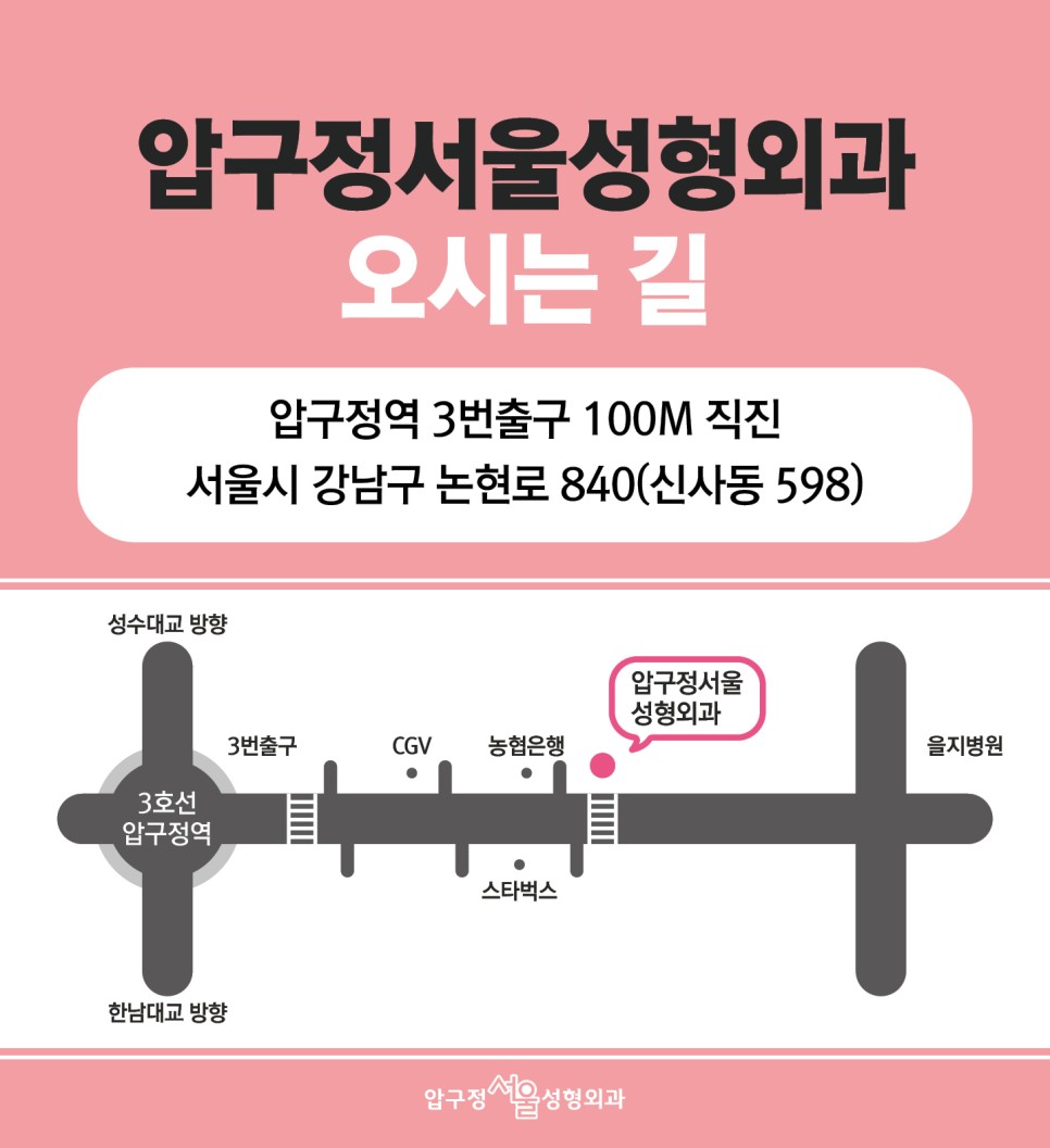 [Apgujeong Best Double Eyelid Clinic] What Is the Difference Between an In-Out and a Semi-Out Double Eyelid Line? image 9