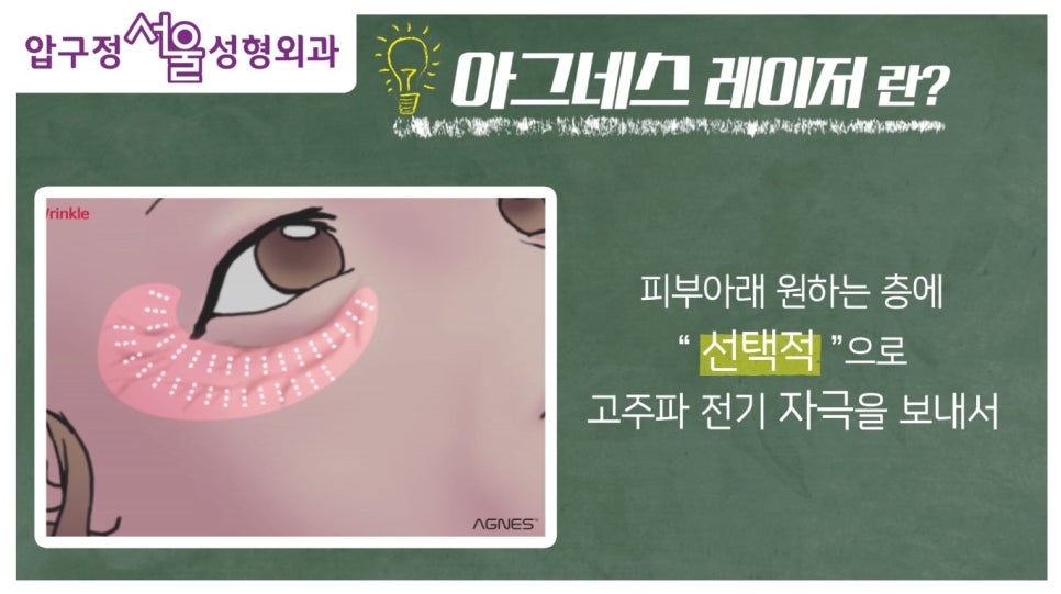 다양한 피부고민 개선, 아그네스레이저란? (리얼 지방 제거영상 有) 관련 이미지 4