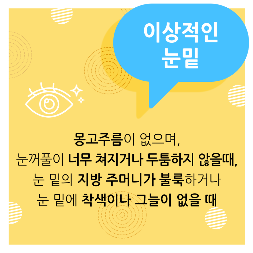 What Is the Ideal Eye Shape, According to Apgujeong Seoul Plastic Surgery? image 5