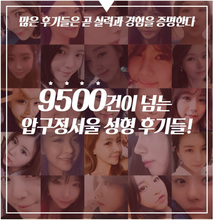 코성형붓기 원래 빨리 빠진다? 관련 이미지 4