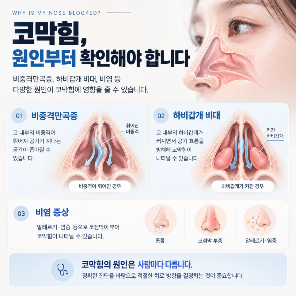"코성형 후에도 코막힘이 남는다면?" 기능코수술 압구정서울성형외과 관련 이미지 4
