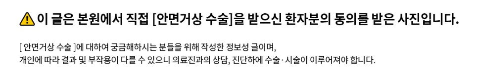 Curious About Reviews of a Clinic That Does Facelift Surgery Well at Apgujeong Seoul Plastic Surgery? image 13