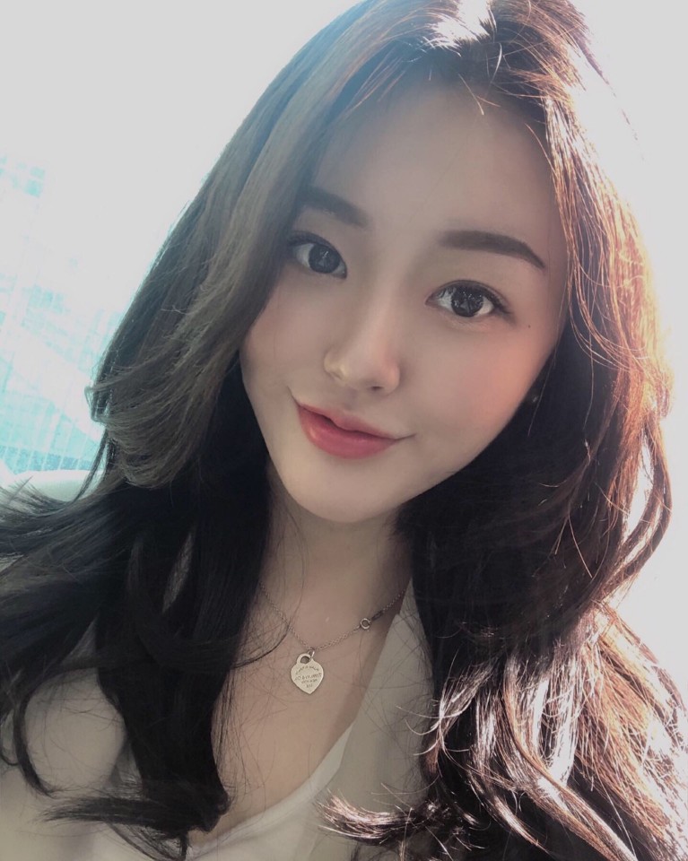 Natural-looking Double Eyelid Surgery at Apgujeong Seoul Plastic Surgery image 1