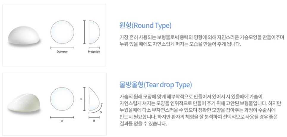 압구정서울성형외과 몰캉몰캉 가슴 보형물 종류 관련 이미지 1