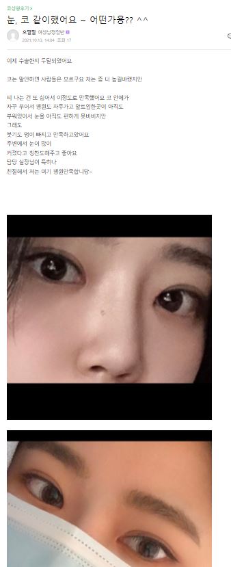 Lovely Eyes Are No Longer Difficult! [Apgujeong Seoul Plastic Surgery] image 7
