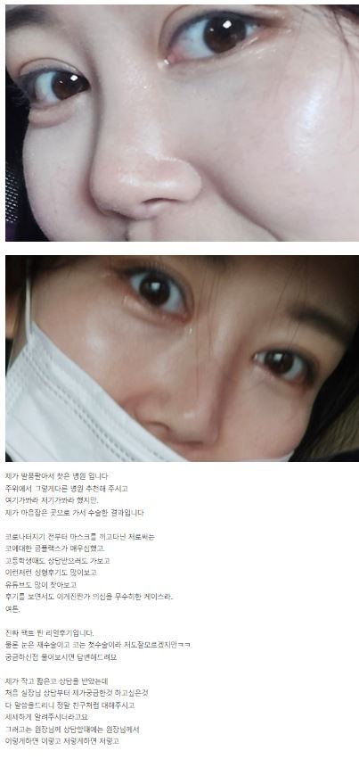 Lovely Eyes Are No Longer Difficult! [Apgujeong Seoul Plastic Surgery] image 3