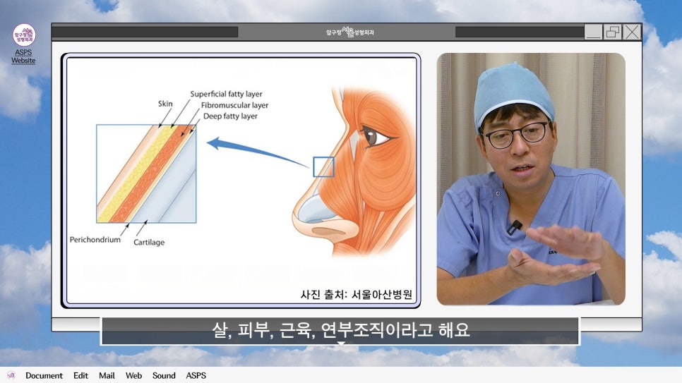 매부리코 코수술 게임 후기 및 비중격연골 매부리 코수술 방법 코수술 진행 과정 압구정서울성형외과 관련 이미지 7