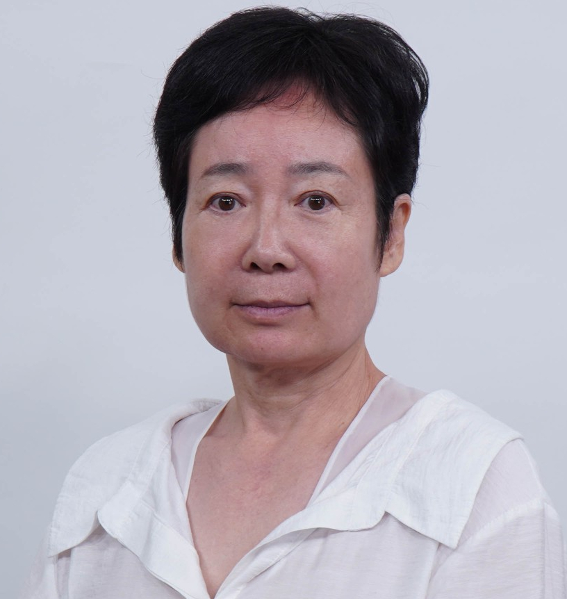 A Dramatic Transformation for Brighter, Clearer Eyes: A 5-Year Follow-Up Review of Forehead Lift Surgery in Your 60s image 9