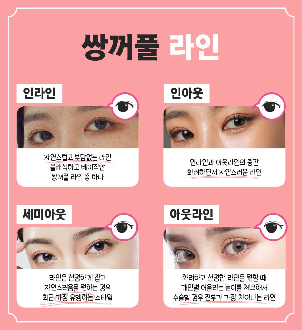“Karina eyes?” “Winter eyes?” What double-eyelid line suits me before getting double eyelid surgery? image 3