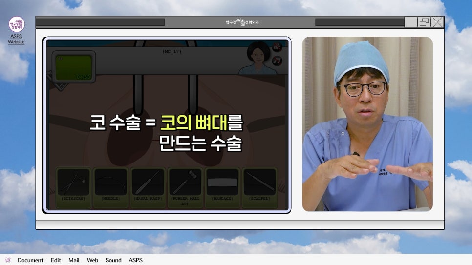 매부리코 코수술 게임 후기 및 비중격연골 매부리 코수술 방법 코수술 진행 과정 압구정서울성형외과 관련 이미지 6