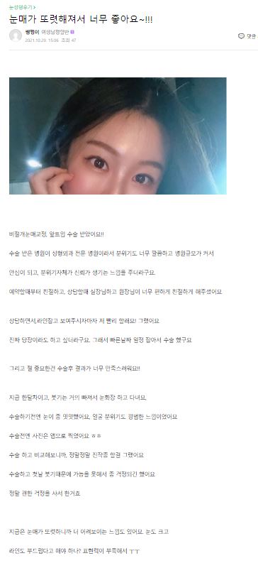 Lovely Eyes Are No Longer Difficult! [Apgujeong Seoul Plastic Surgery] image 9