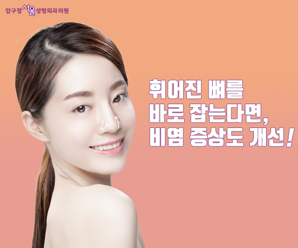 쓴생님~ 비염에도 코수술 가능한가요? 관련 이미지 2