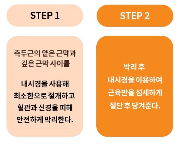 Seoul Plastic Surgery Recommendation: Still Debating It? image 6