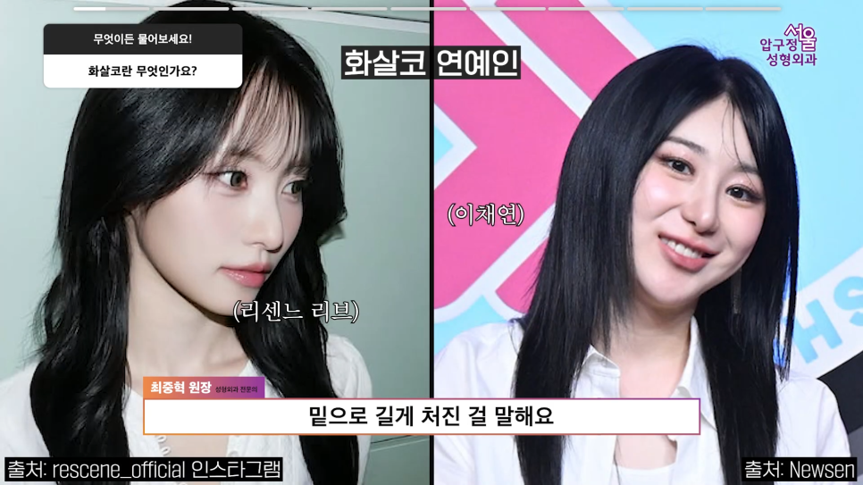 Arrow Nose Correction: The Truth About Self-Diagnosis and Nonsurgical Correction from Apgujeong Seoul Plastic Surgery image 2