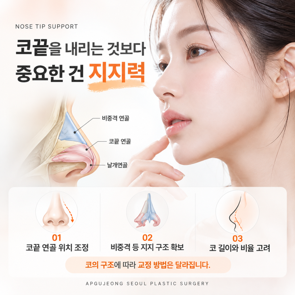 들창코 성형 압구정서울성형외과 "정면에서 콧구멍이 보인다면?" 관련 이미지 3