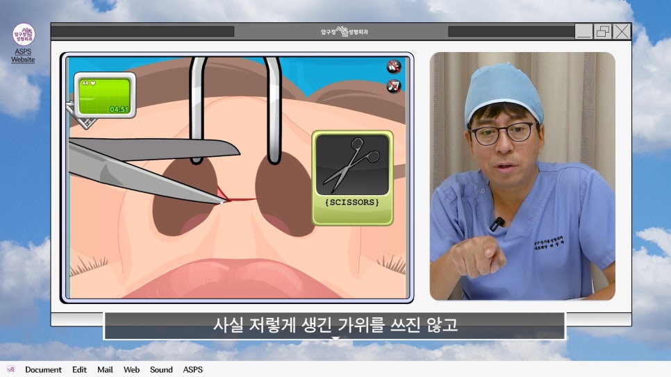 매부리코 코수술 게임 후기 및 비중격연골 매부리 코수술 방법 코수술 진행 과정 압구정서울성형외과 관련 이미지 8