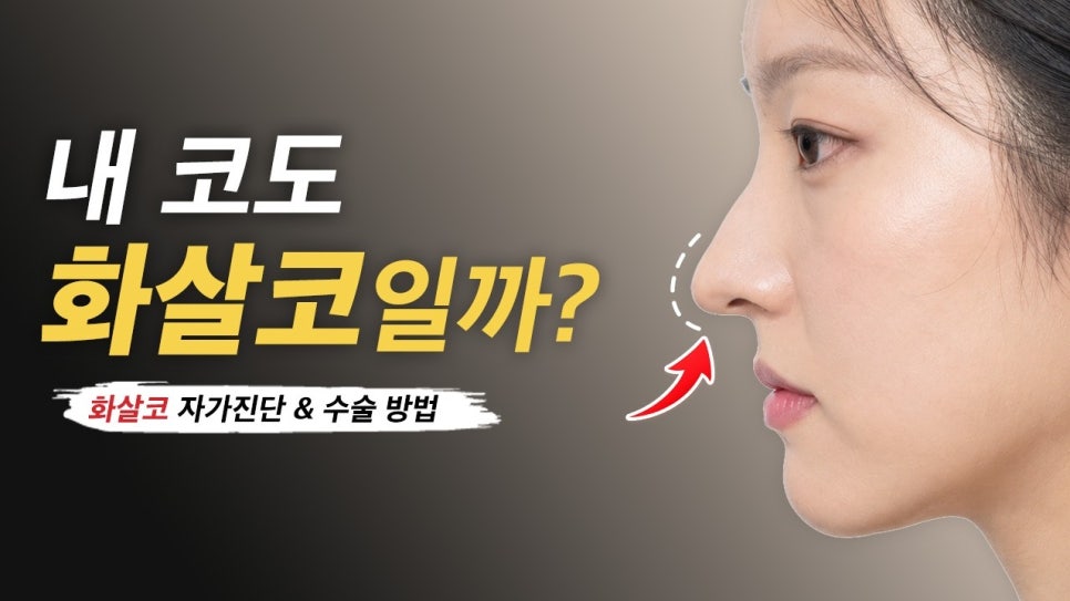 Arrow Nose Correction: The Truth About Self-Diagnosis and Nonsurgical Correction from Apgujeong Seoul Plastic Surgery image 1